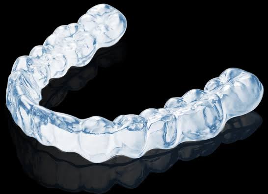 Can Better Smiles Be Practical? A User-Centric Take on lulusmiles’ Aligners
