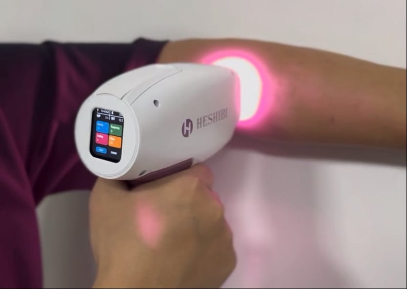 Can ODM Diode Laser Hair Removal Revolutionize Your Hair Removal Routine?